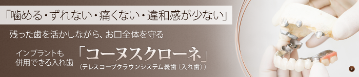 インプラントも併用できる入れ歯「コーヌスクローネ」